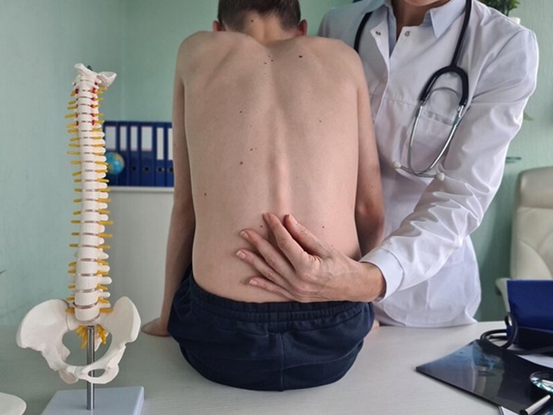 Spotting Early Signs of Spinal Deformities