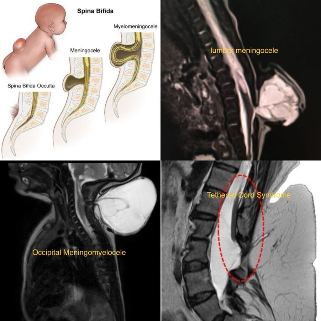 Pediatric Spinal Conditions
