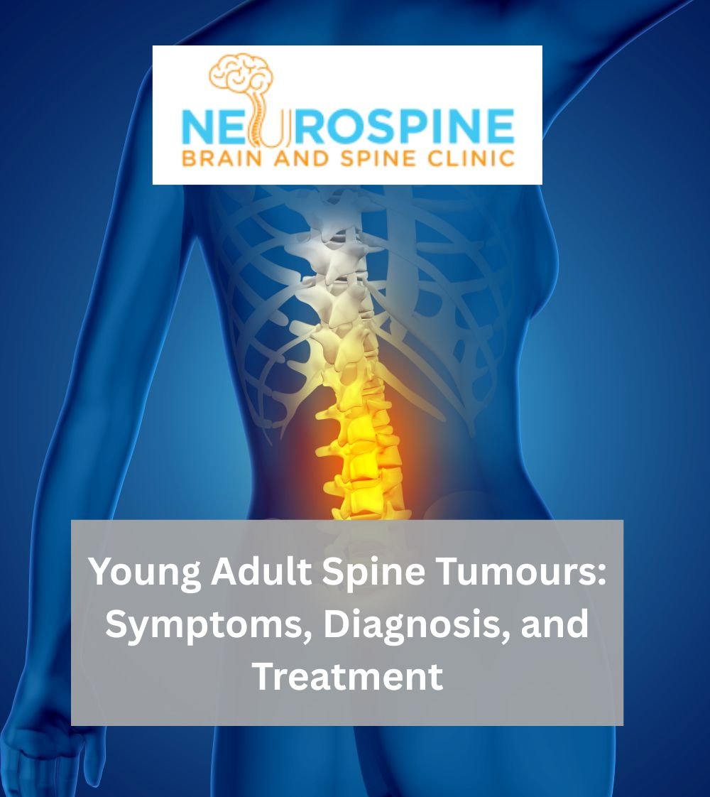 Young Adult Spine Tumours: Symptoms, Diagnosis, and Treatment