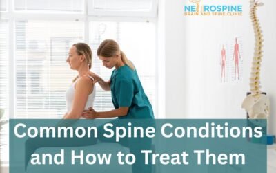 Common Spine Conditions and How to Treat Them