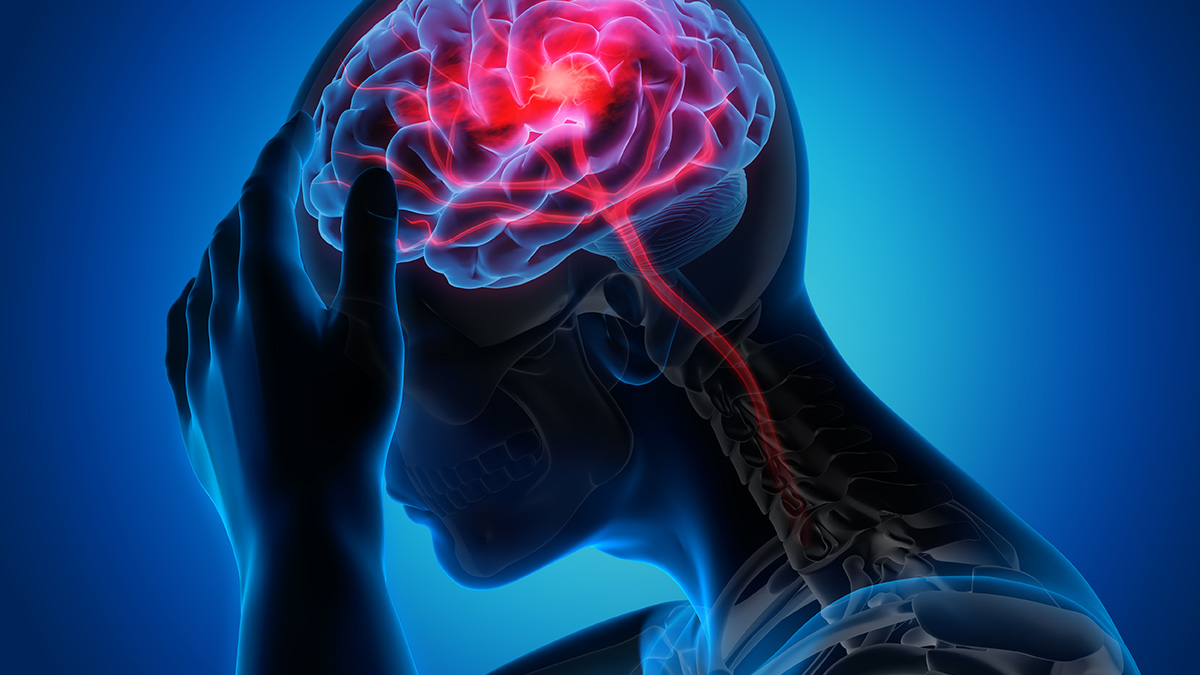 Stroke Recovery & Neurosurgical Care